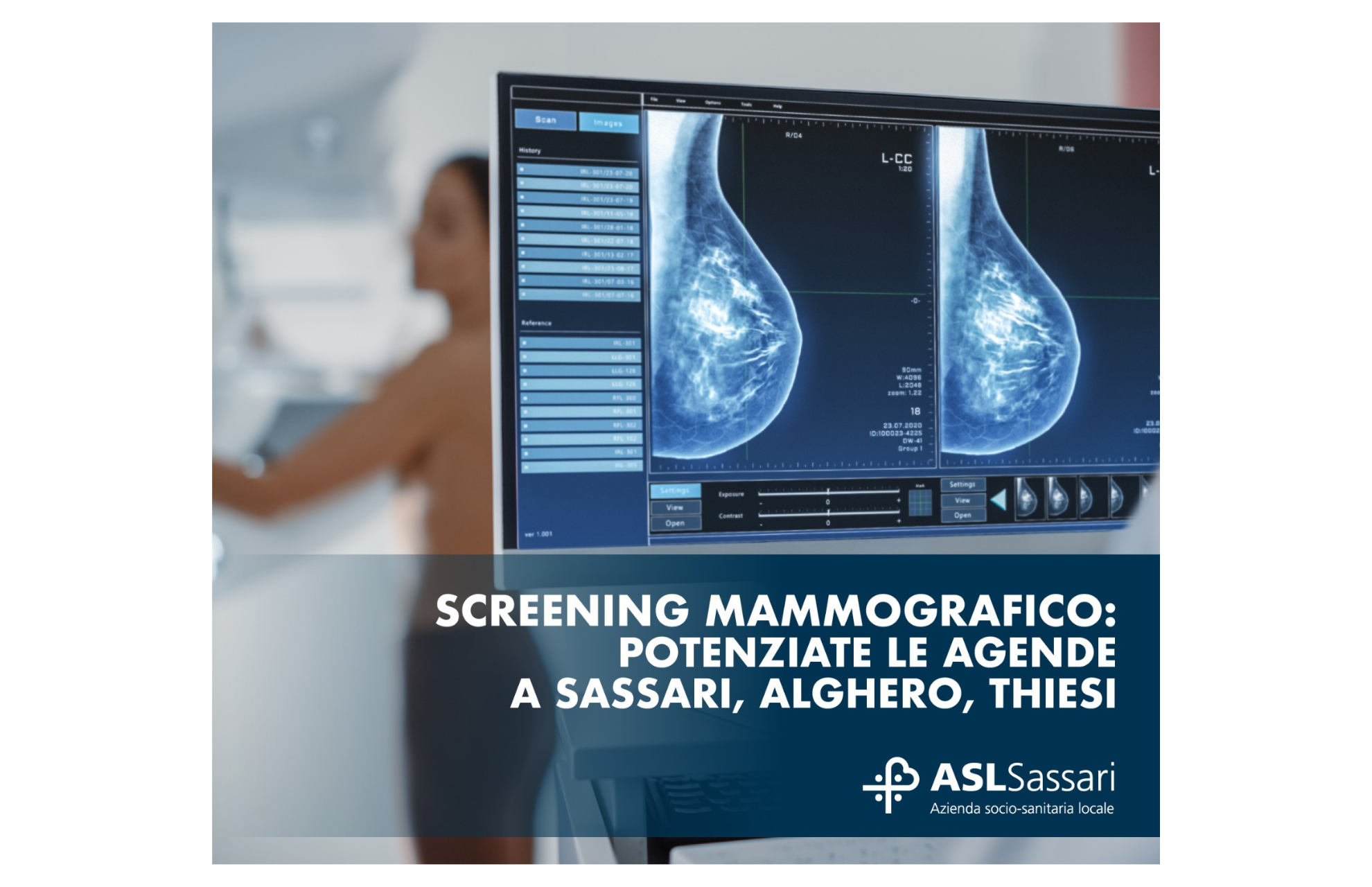 Screening mammografico: potenziamento a Sassari, Alghero e Thiesi