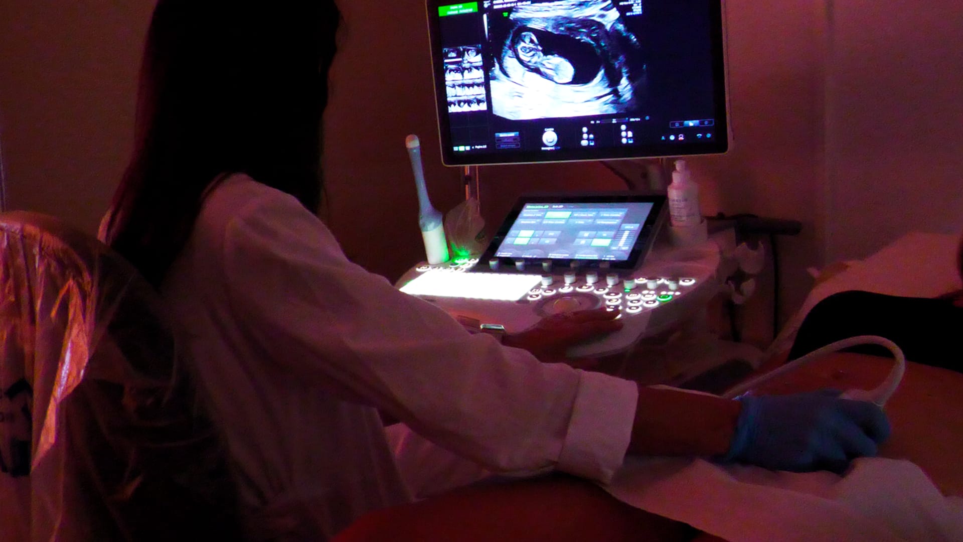 Giornata mondiale della Sindrome Feto-Alcolica